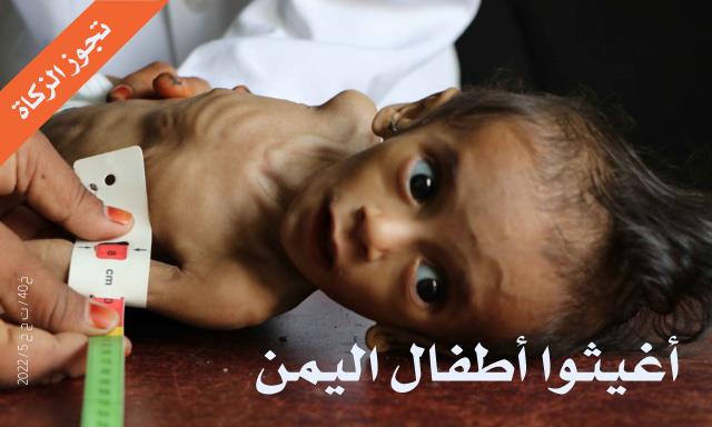 أطفال اليمن | نستهدف علاج 4,500 طفل
