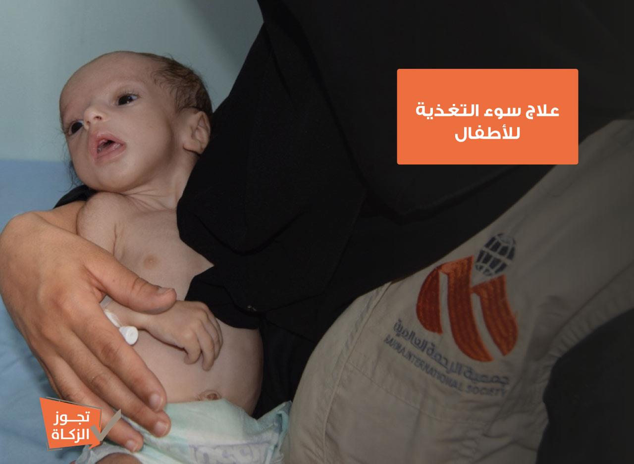 أطفال اليمن | نستهدف علاج 3,000 طفل